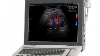 Badania ultrasonograficzne dzieci