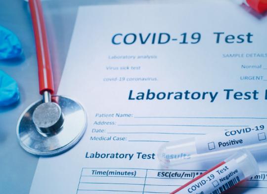 COVID-19 - Test na obecność przeciwciał IgG