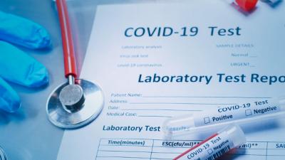 COVID-19 - Test na obecność przeciwciał IgG