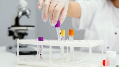 Profile hormonalne dla kobiet i mężczyzn - co zawierają?