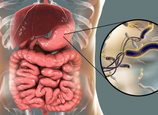 Wszystko o helicobacter pylori - przyczyny, objawy, leczenie