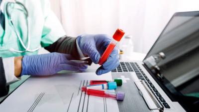 Zaburzenia hormonalne a cykl menstruacyjny - rola tarczycy i prolaktyny